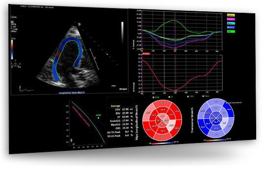 Echocardiography